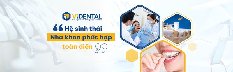 địa chỉ trồng răng Implant tốt nhất Hà Nội
